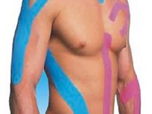 Kinesiology Tape